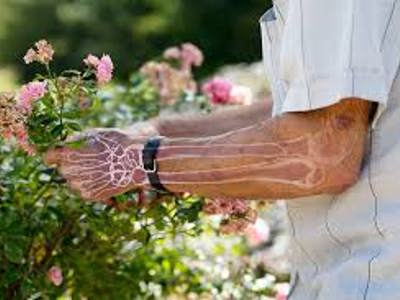 Royal Osteoporosis Society Go-Live on MemEx — listing image